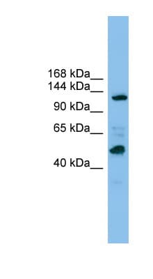 Polyclonal Rabbit anti-Human POLR1B Antibody (aa1007-1056, WB)