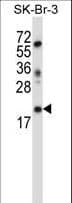 Polyclonal Rabbit anti-Human LIN52 Antibody (aa44-73, IHC, WB)