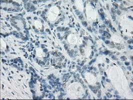 CRYAB / Alpha B Crystallin Antibody (clone OTI5C9)