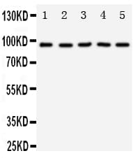 NTRK3 / TRKC Antibody (aa172-186)