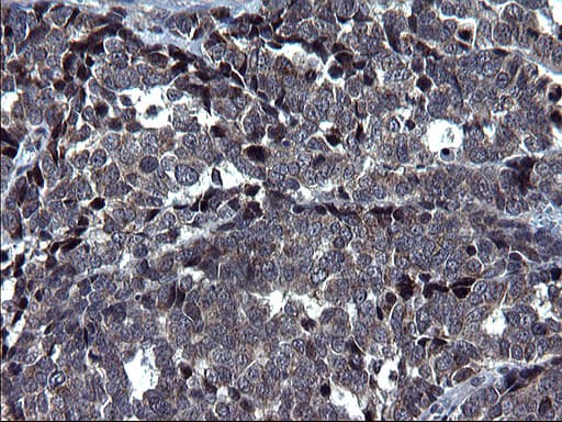 Monoclonal Mouse anti-Human HSCB Antibody (clone OTI3E1, IHC, WB)