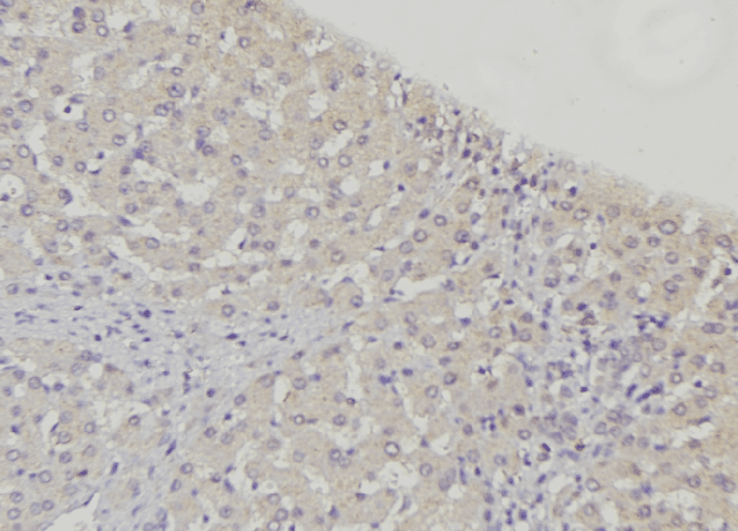 ABCB7 Antibody