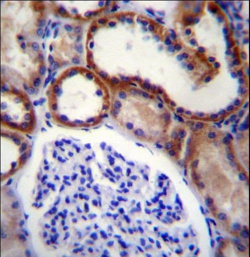 MAP3K15 / ASK3 Antibody (aa315-342)