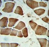 CCDC85B Antibody (aa69-96)