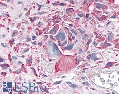 PathPlus™ Polyclonal Rabbit anti-Human NR1D1 Antibody (Internal, IHC)