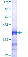 Human DGCR8 Protein (Recombinant GST, N-terminus)