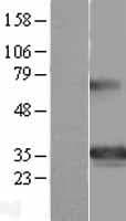GSC / Goosecoid Protein (Over-Expression Lysate Myc-DDK (Flag))