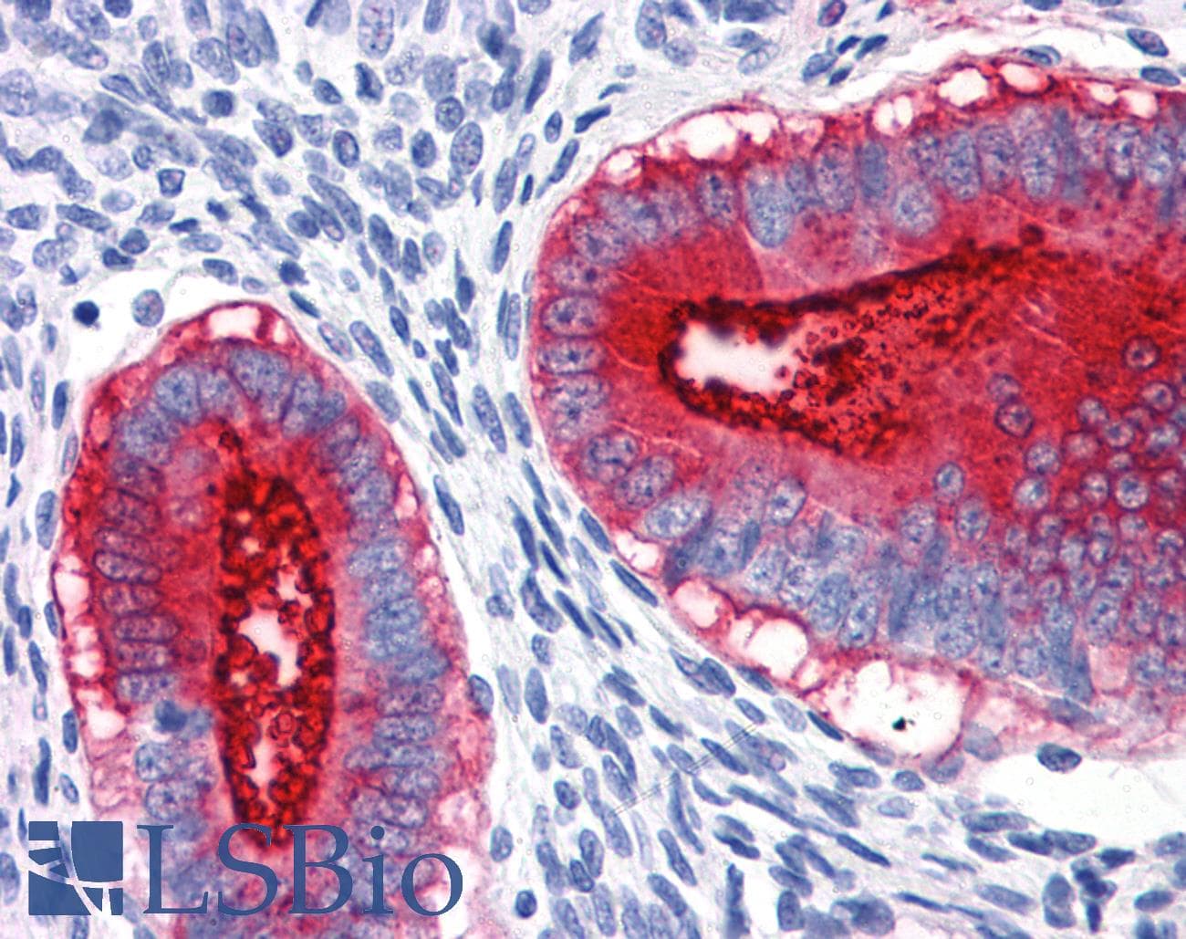 IHC-plus™ EMA / MUC1 Antibody