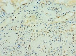 MAS1 / MAS Antibody (aa246-325)
