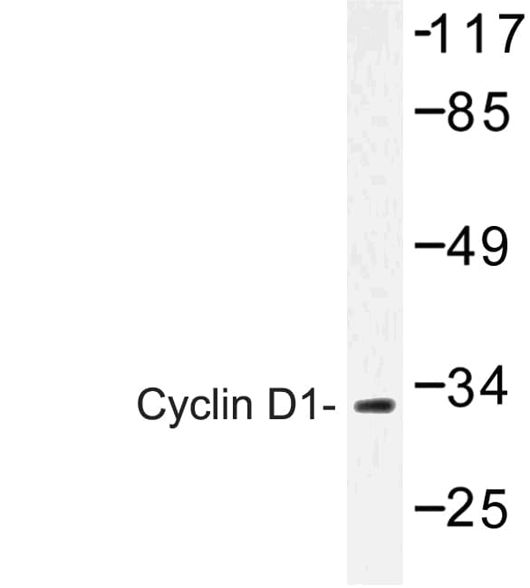 CCND1 / Cyclin D1 Antibody (Asp86)