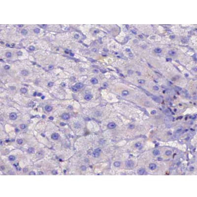 IRS1 Antibody (phospho-Ser307)