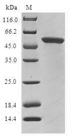 Human GLYATL1 Protein (Recombinant GST, N-terminus)