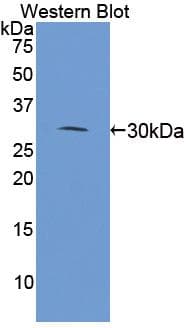 MAP4 Antibody (aa2-250)