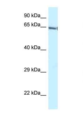 GATAD2B Antibody (C-Terminus)