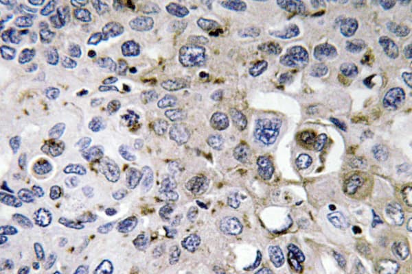 Polyclonal Rabbit anti-Human PDGF-AA Antibody (Lys154, IHC, WB)