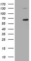 PKLR Antibody (clone OTI1H2)