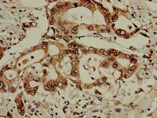 EIF3M / PCID1 Antibody