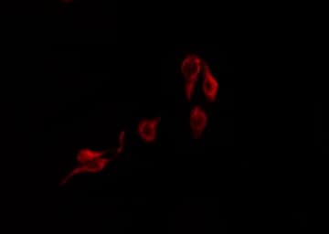 IGFALS / ALS Antibody