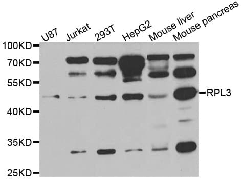 IHC-plus™ Polyclonal Rabbit anti-Human RPL3 / Ribosomal Protein L3 Antibody (IHC, WB)
