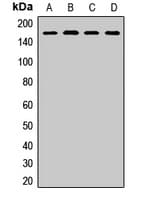 Polyclonal Rabbit anti-Human SAFB1 / SAFB Antibody (WB)