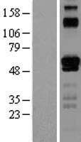 ETV6 / TEL Protein (Over-Expression Lysate Myc-DDK (Flag))