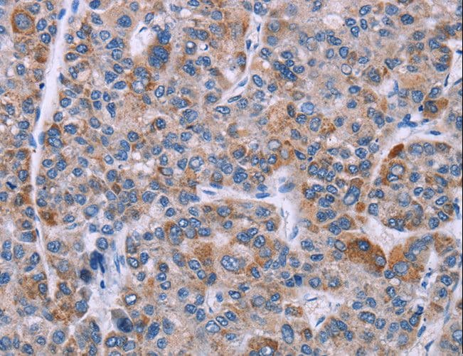 Polyclonal Rabbit anti-Human KRT14 / CK14 / Cytokeratin 14 Antibody (IHC, WB)