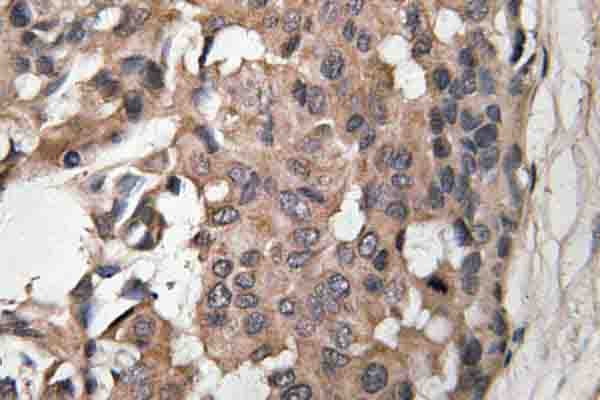 BRAF / B-Raf Antibody (Lys439)