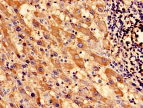 Polyclonal Rabbit anti-Human SOCS3 Antibody