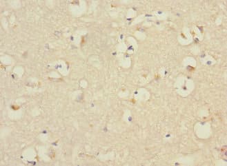 Polyclonal Rabbit anti-Human PTPN18 Antibody (IHC)