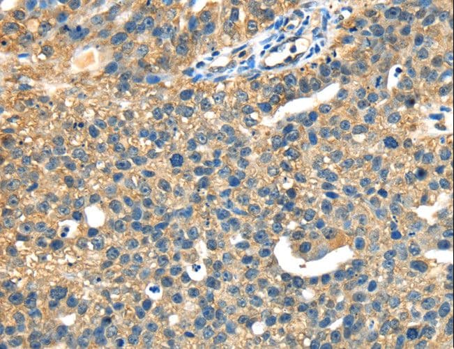 DHCR24 / Seladin-1 Antibody