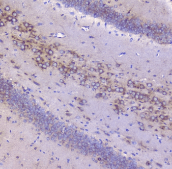 Polyclonal Rabbit anti-Mouse IGF2R / CD222 Antibody (IHC, WB)