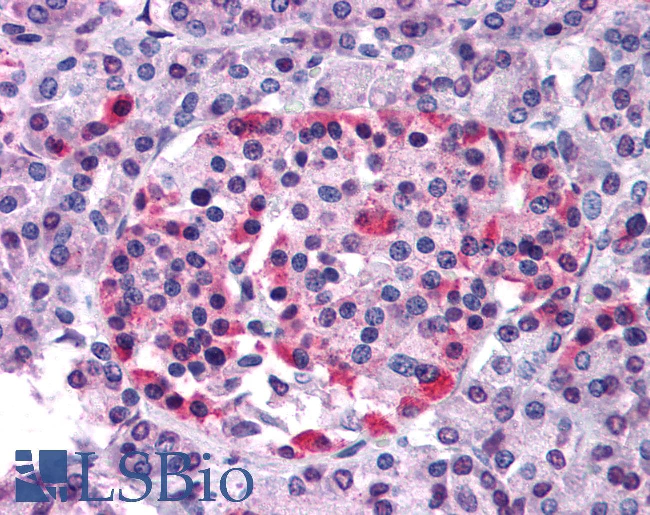 IHC-plus™ Polyclonal Rabbit anti-Human FKSG80 / GPR81 Antibody (N-Terminus, IHC)