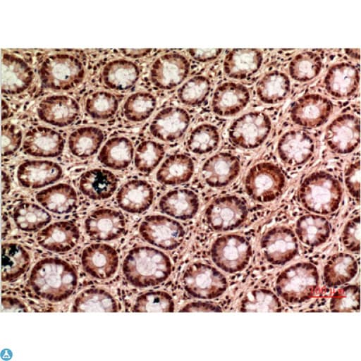 TUBG1 / Tubulin Gamma 1 Antibody