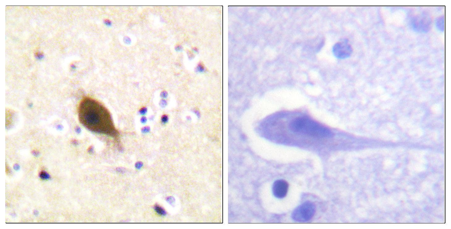 SCNN1B / ENaC Beta Antibody (Ab-615)