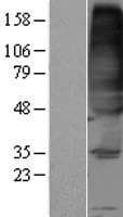 FVT1 / KDSR Protein (Over-Expression Lysate Myc-DDK (Flag))