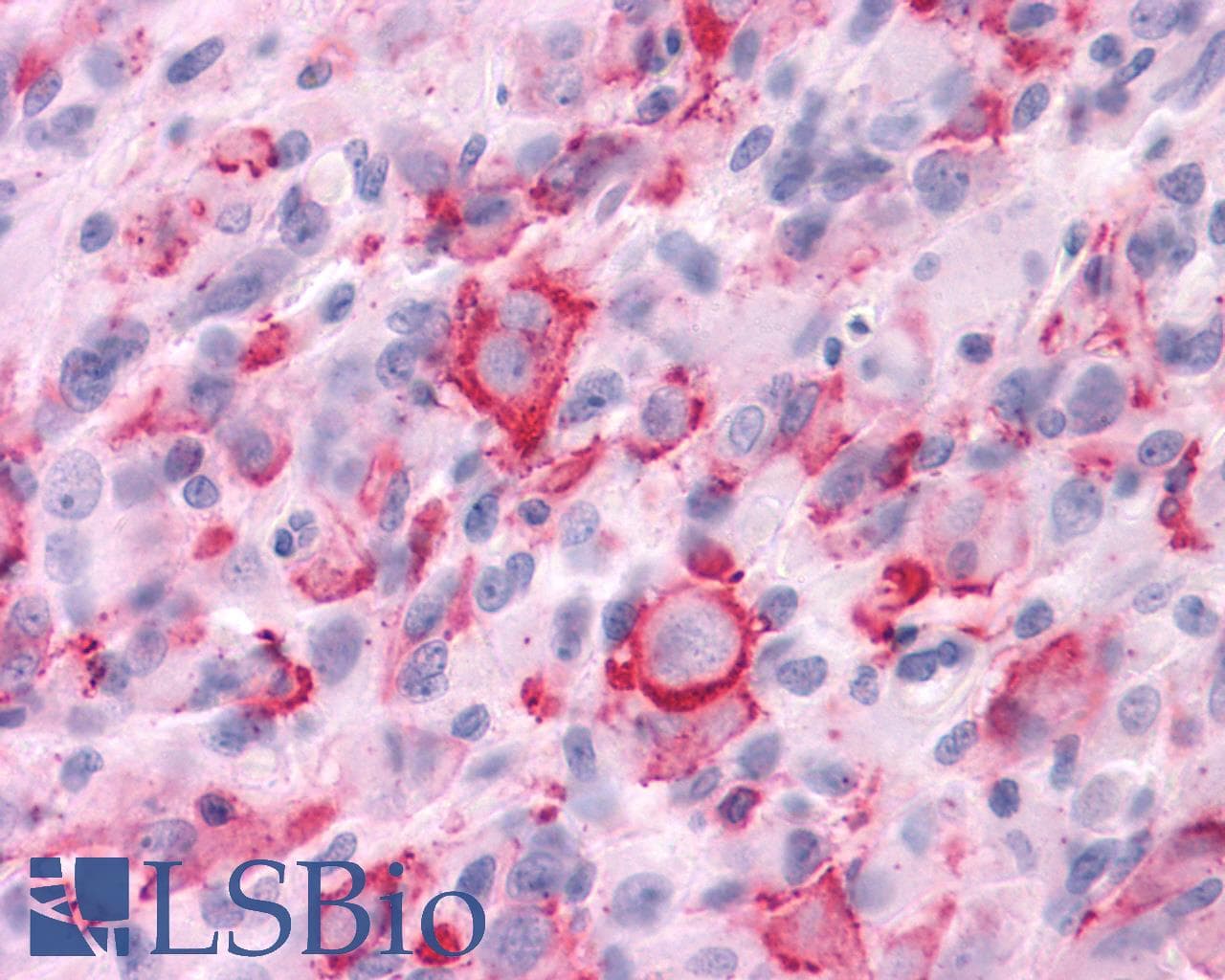 PathPlus™ CHRM3 / M3 Antibody (C-Terminus)