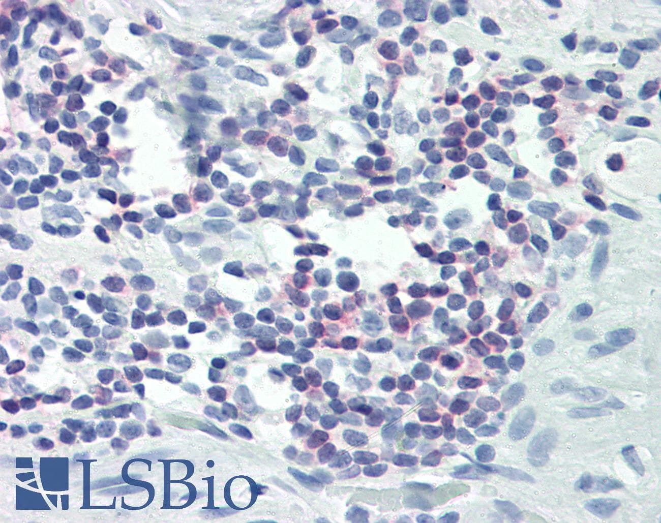 IHC-plus™ Polyclonal Rabbit anti-Human PLCG1 Antibody (C-Terminus, IHC, WB)