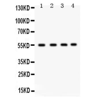 GJA3 / CX46 / Connexin 46 Antibody (aa89-118)