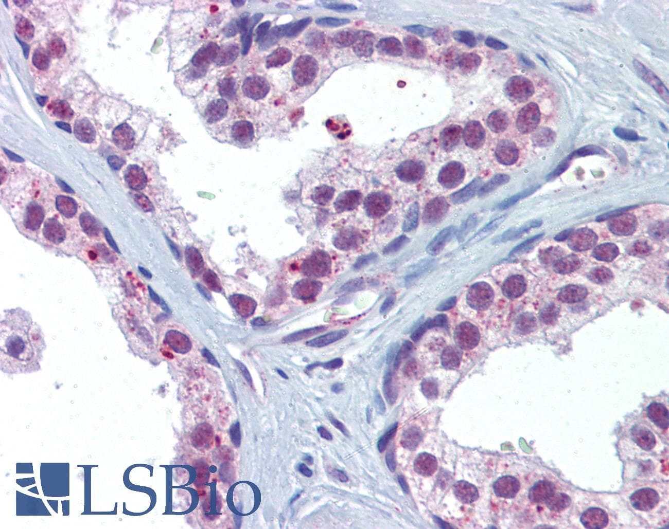 IHC-plus™ Polyclonal Rabbit anti-Human AKT1 + AKT2 Antibody (IHC, WB)