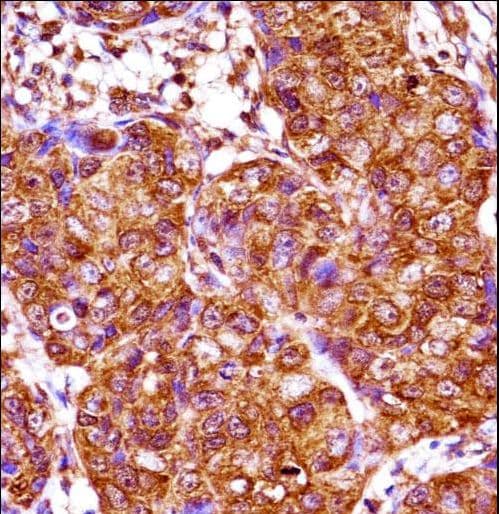 Polyclonal Rabbit anti-Human IRX3 Antibody (aa111-140, IHC, WB)