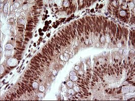 LMO2 Antibody (clone OTI1D7)
