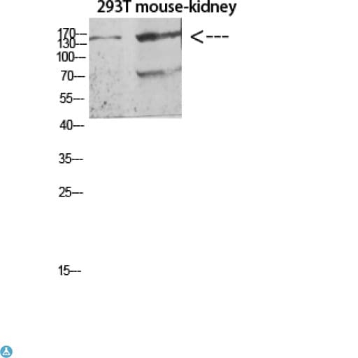 FLT4 / VEGFR3 Antibody (aa640-700)