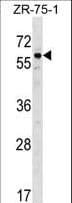 BMP3 Antibody (aa318-347)
