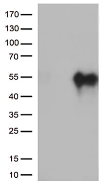 HAVCR2 / TIM-3 Antibody (clone OTI13B10)