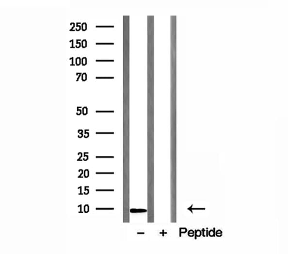 SHSF1 / SHFM1 Antibody (aa21-40)