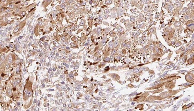 SYT1 / Synaptotagmin Antibody