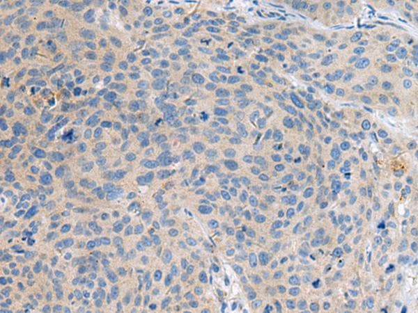 KIAA0556 Antibody