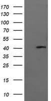 MAPK13 / p38delta Antibody (clone OTI12D11)