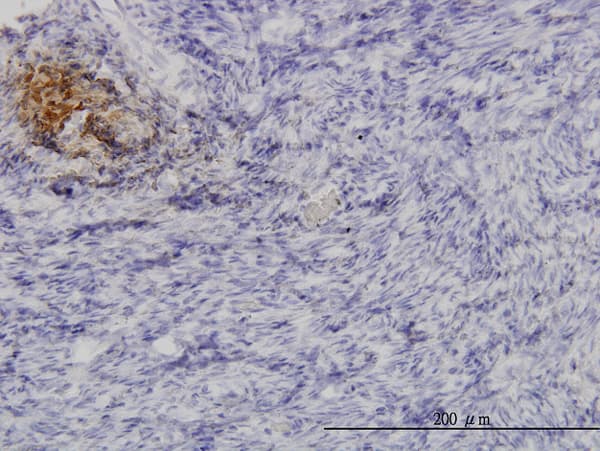 ANGPTL1 Antibody (clone 3A5)