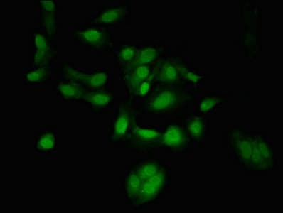 TSR1 Antibody